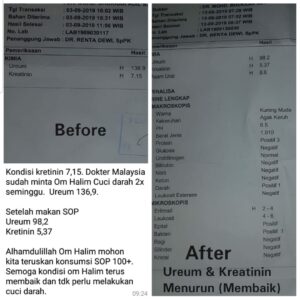 testimoni AFC ginjal