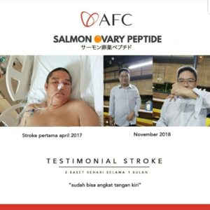 testimoni sop subarashi stroke