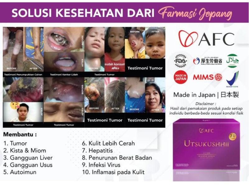 Testimoni Utsukushhii Gold