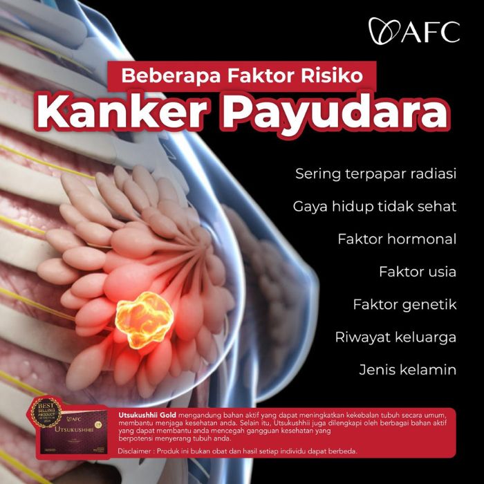 kanker payudara