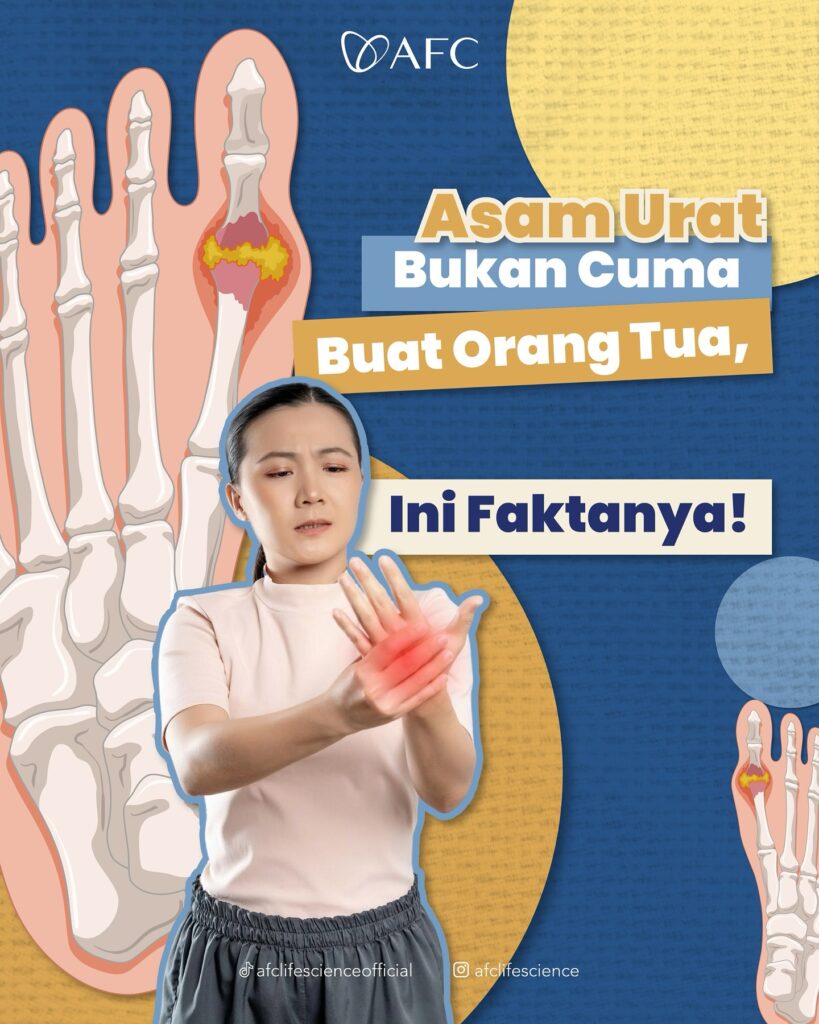 Cara Mengatasi Asam Urat