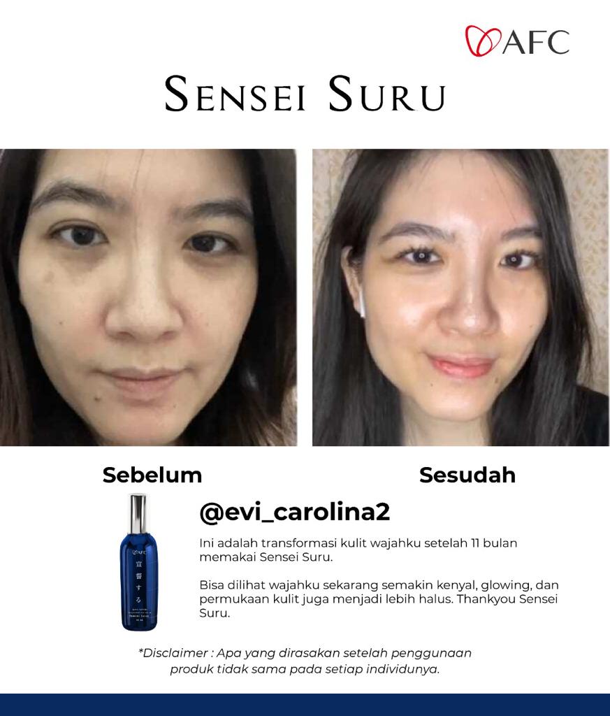 Testimoni sensei suru